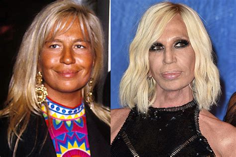 donatella versace dopo lincidente|donatella versace story.